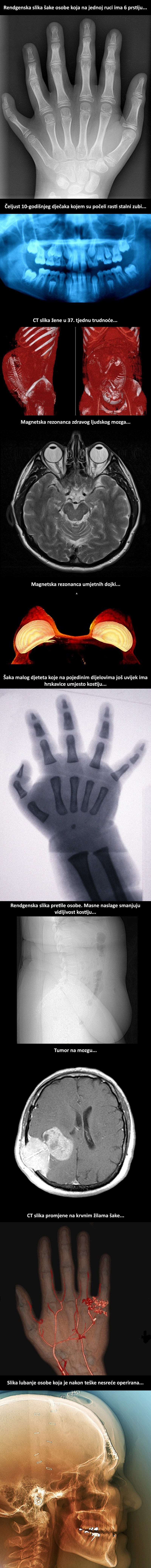 10 neočekivanih slika koje prikazuju ljudsko tijelo na jedan sasvim drugi način