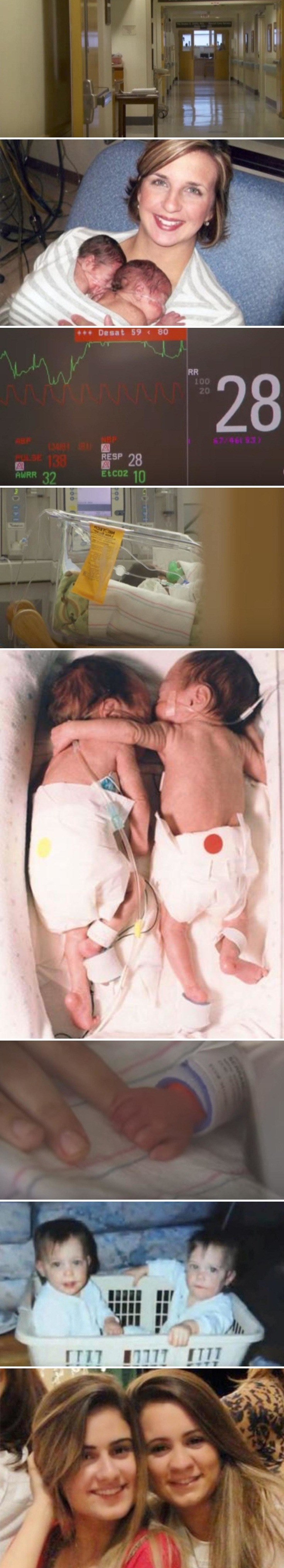 ČUDESNI ZAGRLJAJ Medicinska sestra otvorila inkubator i spasila blizanku koja je prestala disati