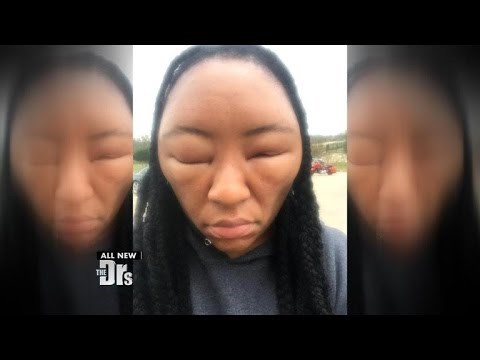 VIDEO Žena ofarbala kosu, ubrzo nakon toga pojavila se uznemirujuća nuspojava koja joj je promijenila lice