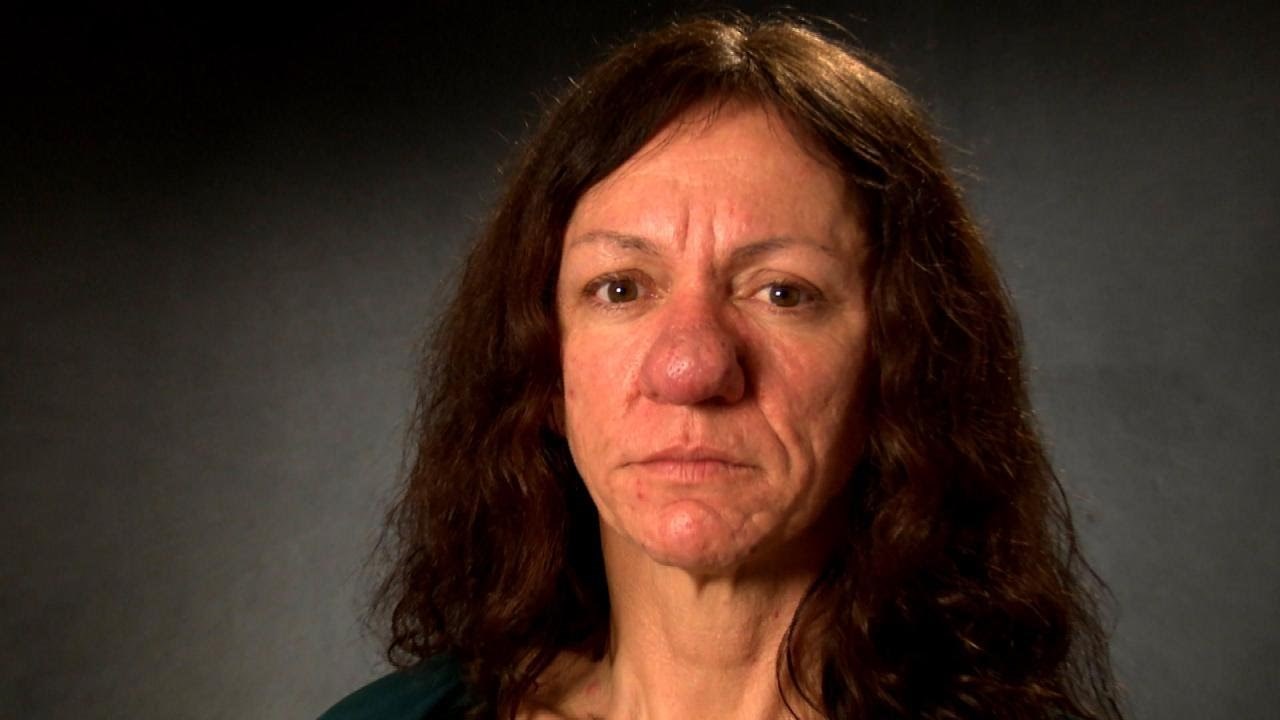 VIDEO Nos joj nije prestajao rasti, a onda je dobila operaciju koja joj je promijenila život