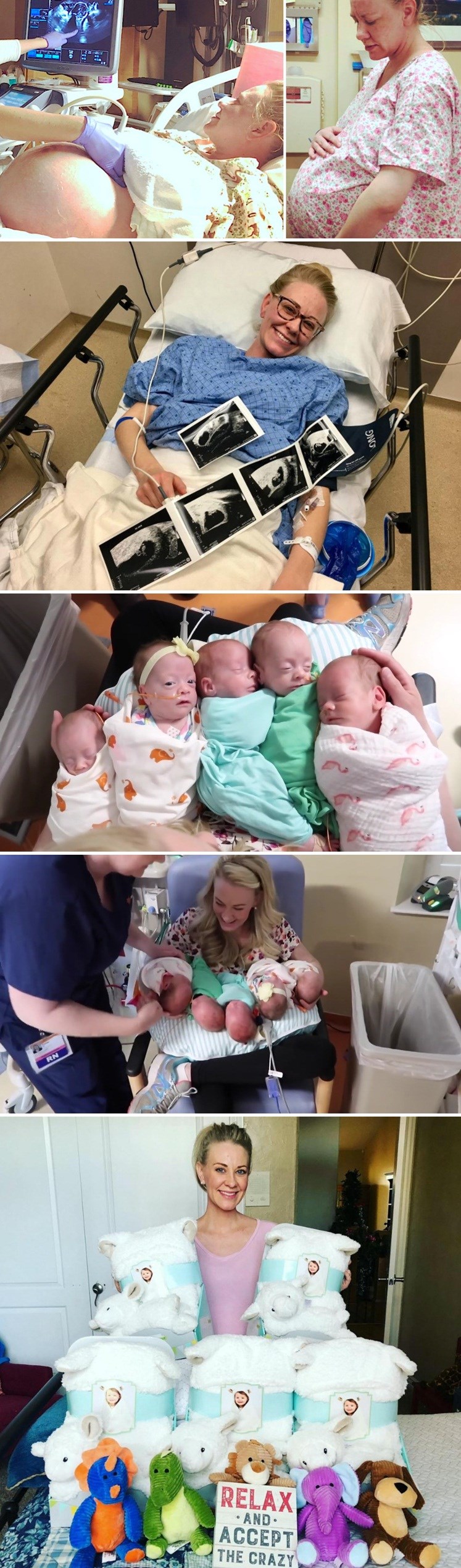 Mama s ogromnim trudničkim trbuhom doživjela je nešto što se događa jako rijetko