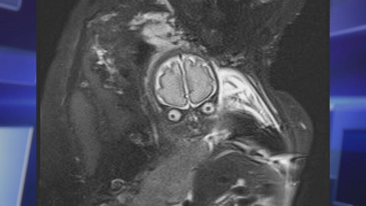 BEBIN JEZIVI POGLED Trudnica je nakon pregleda dobila sliku, začudila se kad je ugledala ovo