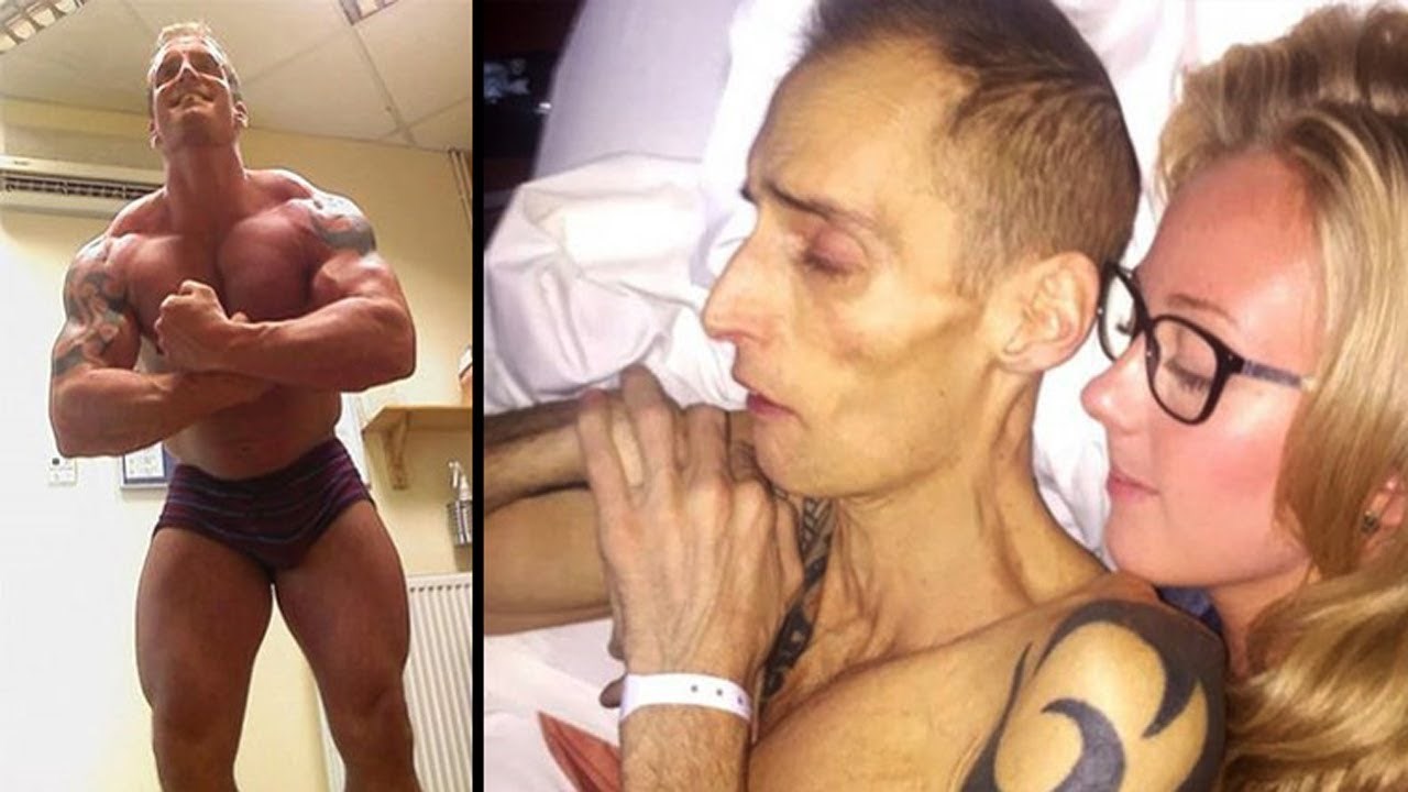 Muškarac je svaki dan pio po nekoliko energetskih napitaka, evo što mu se dogodilo