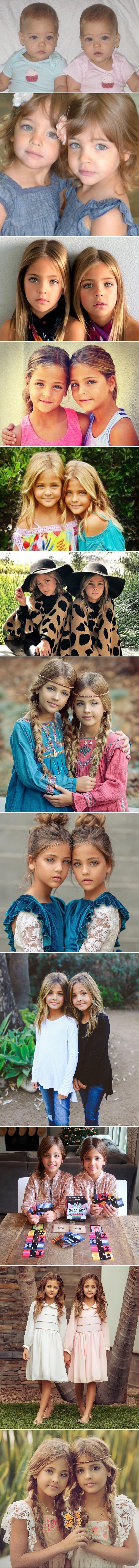 Prije 8 godina su rođene kao identične bebe, danas ih nazivaju najljepšim blizankama na svijetu