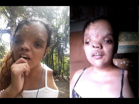 VIDEO Mlada žena je svoje fizičke nedostatke stavila u drugi plan i oduševila svijet predivnim glasom