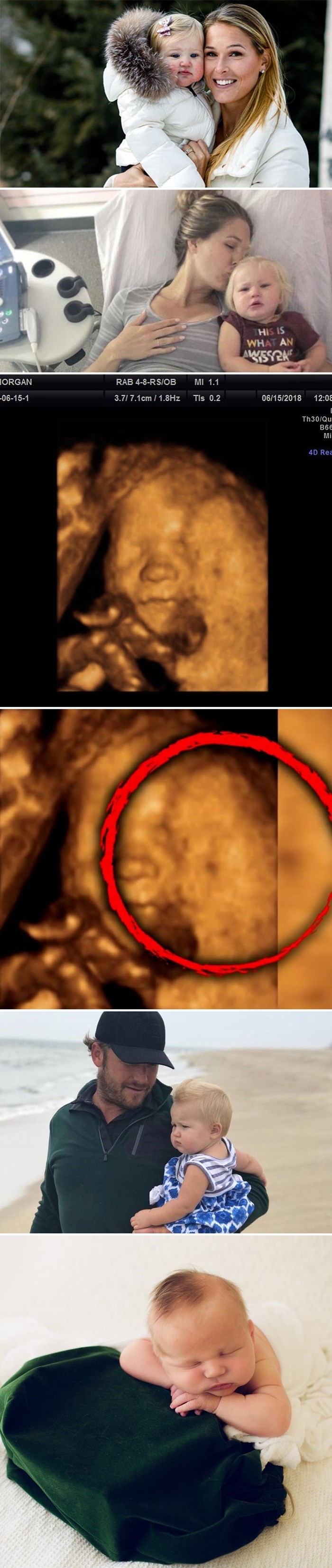 Samo nekoliko dana nakon što je ostala bez kćerkice, mama je na ultrazvuku primijetila čudan detalj