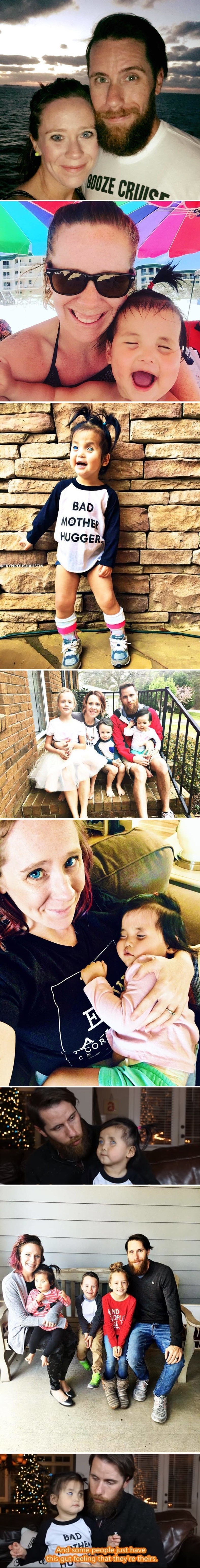 Kad su vidjeli njene "srebrne" oči, mladi par je znao da moraju posvojiti ovu malu djevojčicu