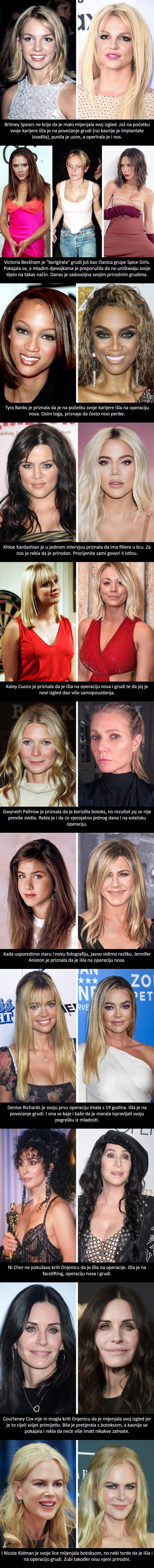 Ove poznate žene ni ne pokušavaju kriti činjenicu da su išle na operacije. Evo što su sve mijenjale na sebi