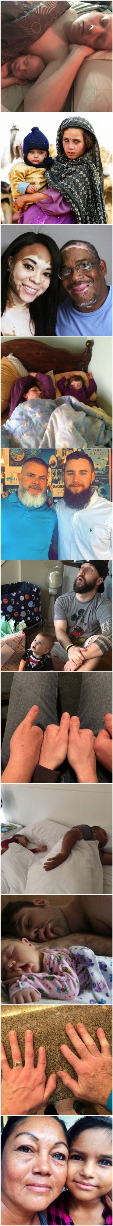 Ova djeca su naslijedila nešto vrlo posebno od svojih roditelja