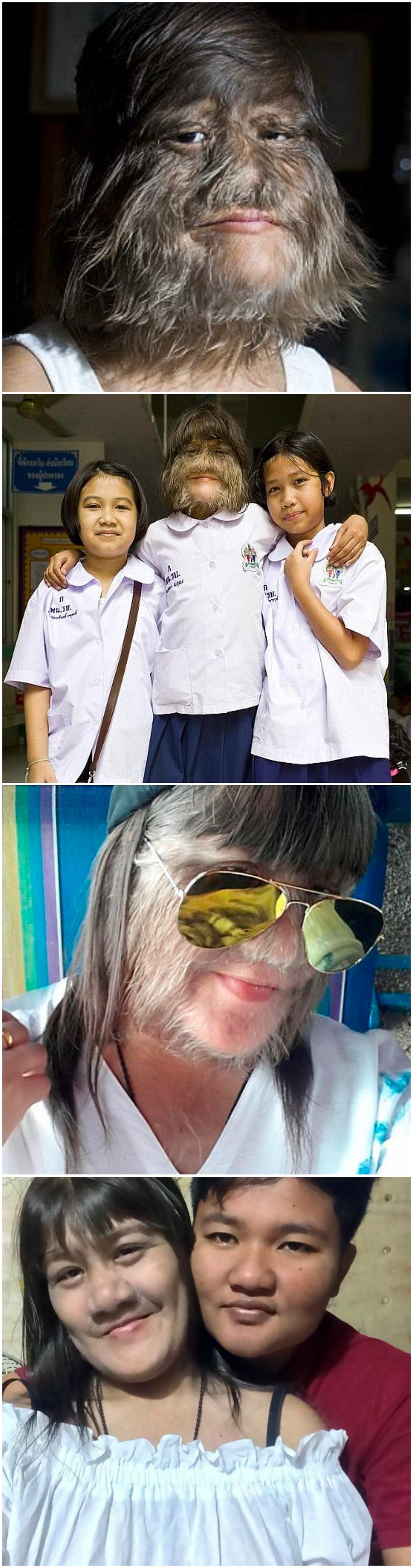 Najdlakavija djevojka na svijetu obrijala se nakon što je upoznala ljubav svog života