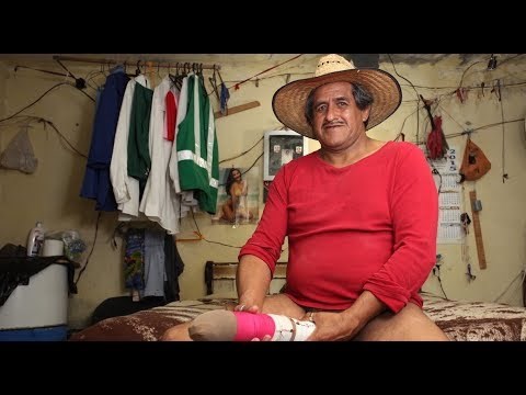 VIDEO Pogledajte kako izgleda život čovjeka s penisom od pola metra