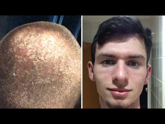 Dvije godine nije koristio šampon pa pokazao kako mu kosa izgleda nakon toga