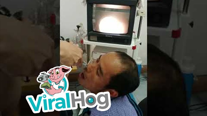 VIDEO Nećete vjerovati što je doktor izvukao iz nosa svog pacijenta