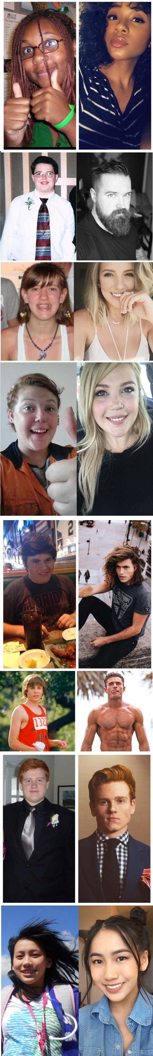 Od ružnih pačića do ljepotana - Ovi su ljudi doživjeli transformacije i očarali cijeli svijet