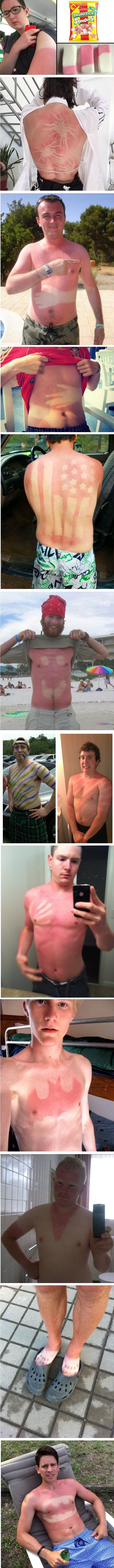 Strašno su izgorjeli na suncu, a njihove fotke u vama će izazvati bol i smijeh