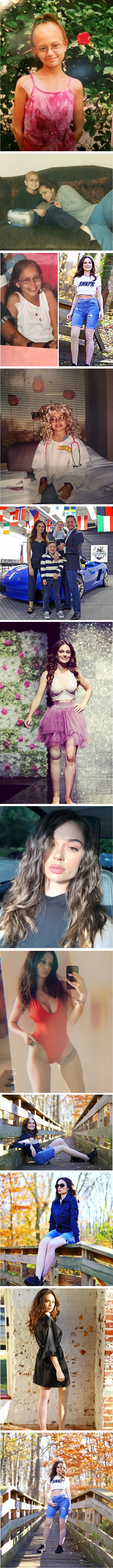 S 11 godina amputirali su joj nogu, no to je nije spriječilo da postane najbolja verzija sebe