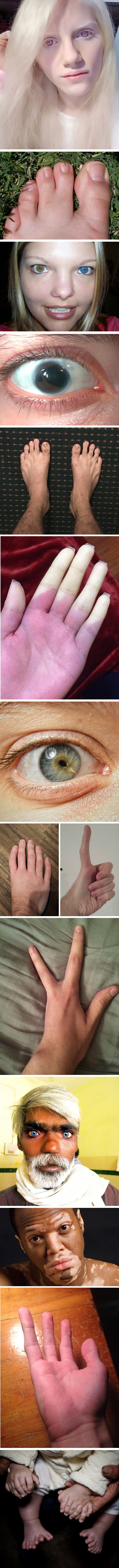 Fotke neobičnih dijelova tijela ovih ljudi začudile korisnike društvenih mreža