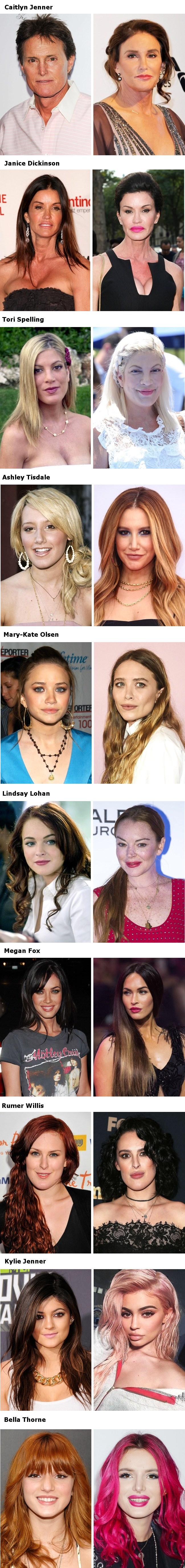 Ove slavne osobe plastičnim operacijama potpuno su promijenile svoj izgled