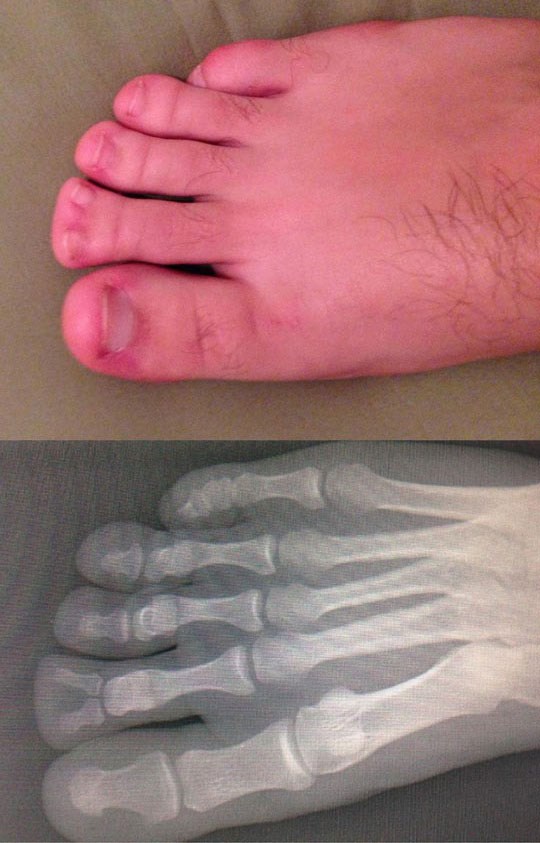 Ako mislite da imate ružne prste na nogama, nakon ovog ćete se predomisliti 