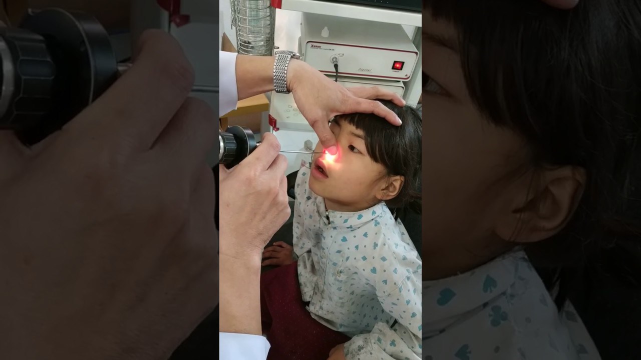 Djevojčici liječnik izvadio odvratnog nametnika iz nosa, ona to podnijela stoički