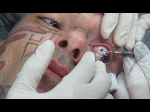 Odlučio je tetovirati bjeloočnicu i to izgleda jezivo