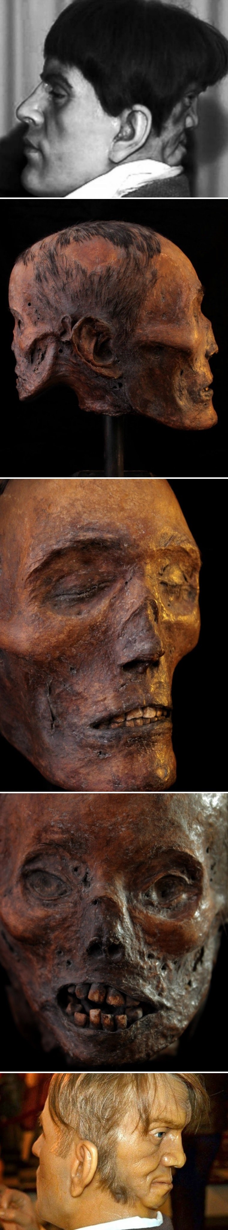 Priča o Edwardu Mordakeu, misterioznom mladiću koji je s druge strane glave imao "blizanca iz pakla"