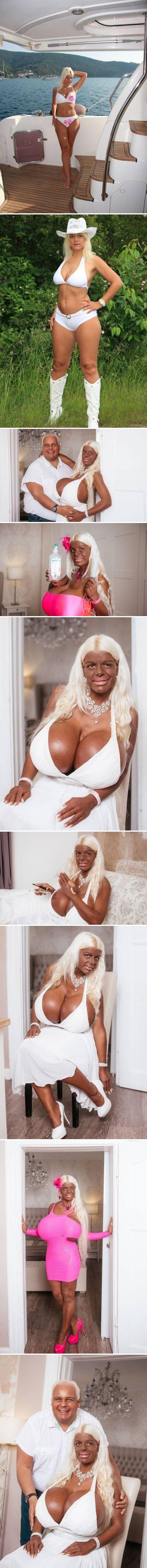 Previše se voljela sunčati, a estetske operacije su joj prirasle srcu. Danas izgledao kao da je izašla iz horora!