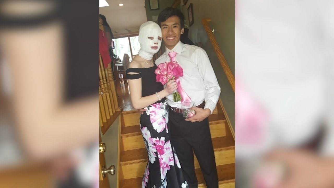 Prijatelji joj priredili dan za pamćenje nakon što je teško nastradala od eksplozije