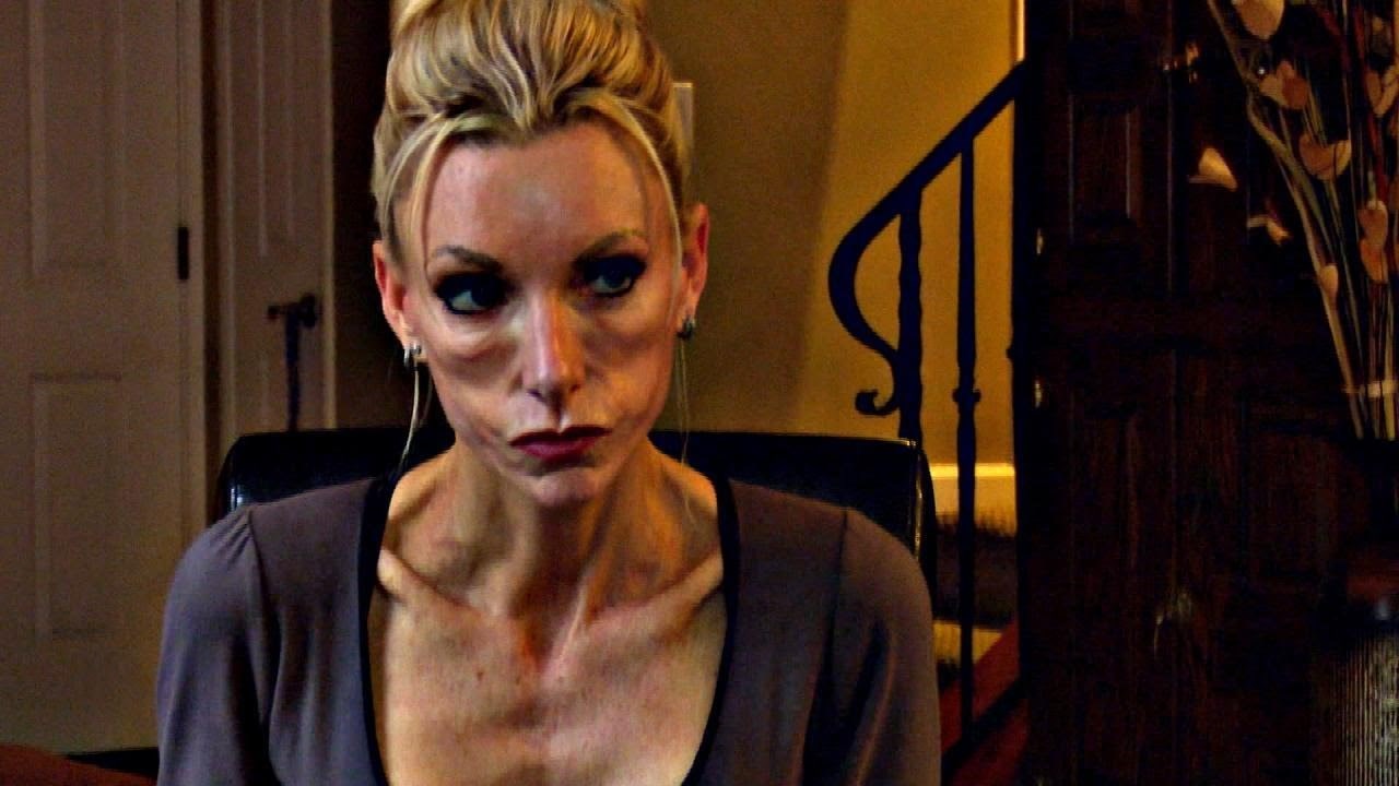 Zbog svoje tajne je postala ovisna o vježbanju, pogledajte kako danas izgleda!