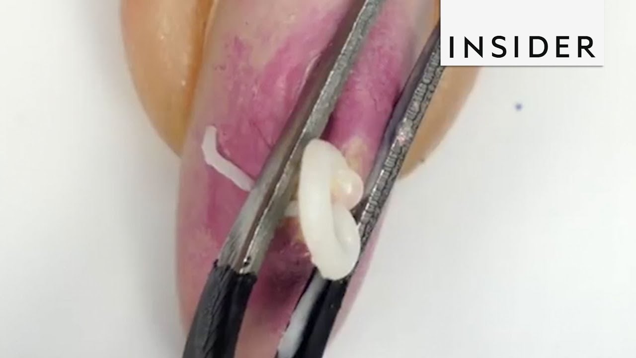 Ova žena nokte pretvara u prištiće spremne za tiskanje i to izgleda odvratno