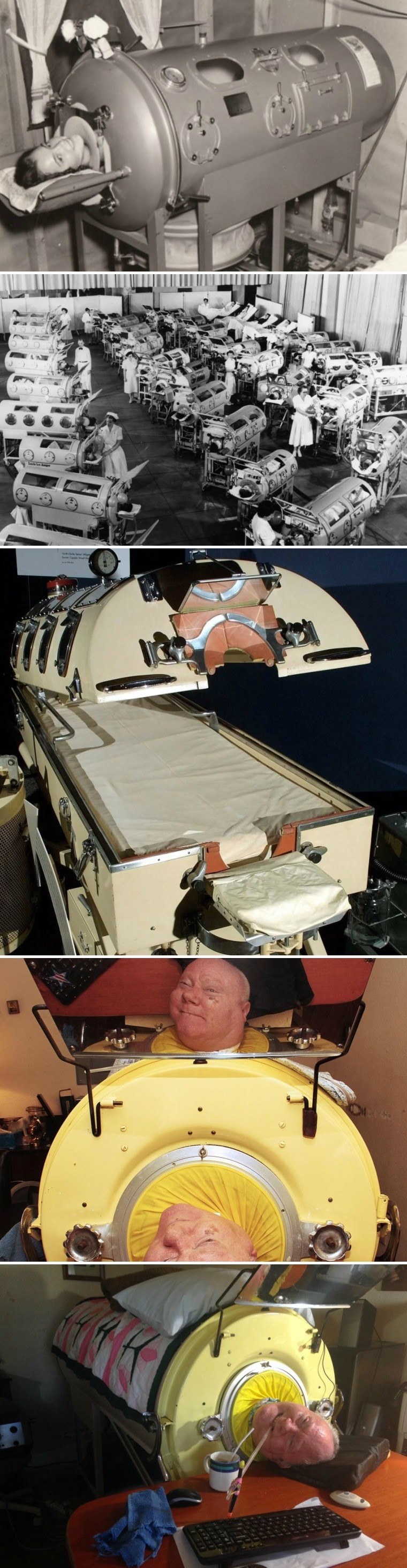 Ovaj muškarac zatvoren je u metalnom stroju više od 60 godina, a razlog će vam slomiti srce