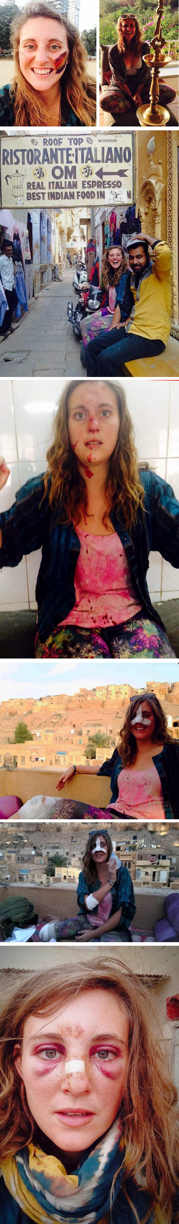 Na putovanju je zadobila ozljede koje će pamtiti cijeli život