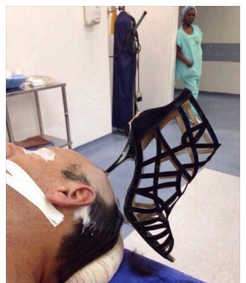 Ako je nakon ove "nezgode" ostao s njom, onda je riječ o pravoj ljubavi