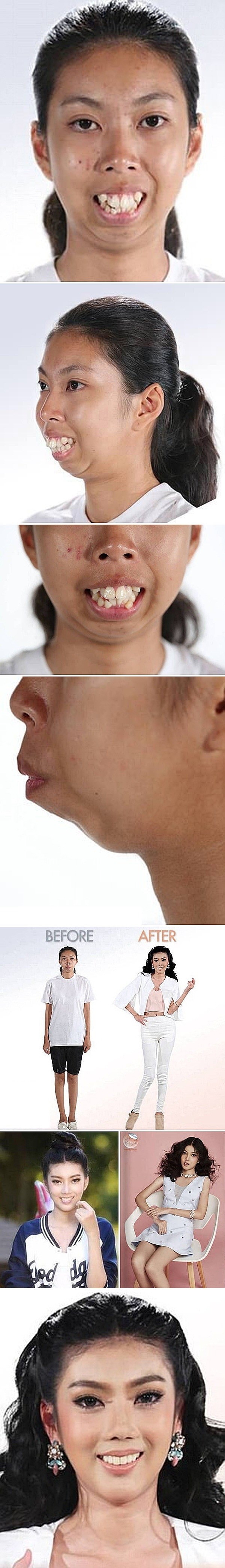 Djevojka je zbog svog izgleda cijeli život trpila uvrede, danas izgleda kao prava mankenka!