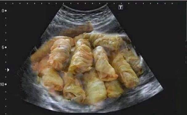 Ovih blagdana očekujemo ovakvu prognozu u utrobama većina Balkanaca