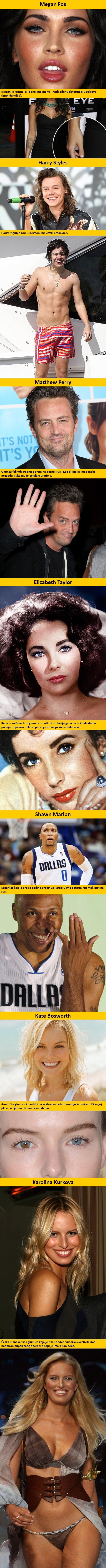 Sedam slavnih osoba koje imaju neobične dijelove tijela 