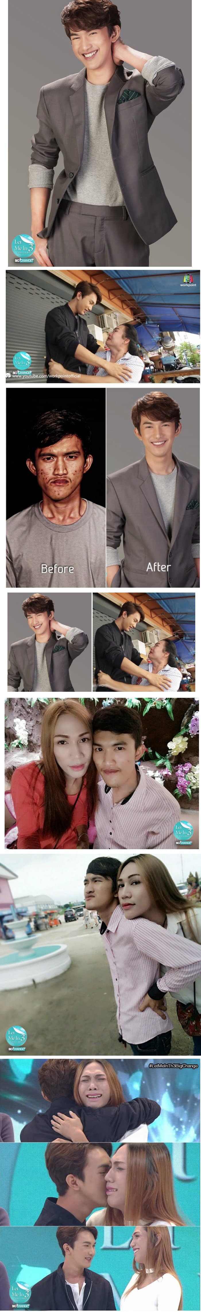 Potpuna promjena izgleda - Majka ga nije prepoznala nakon plastične operacije