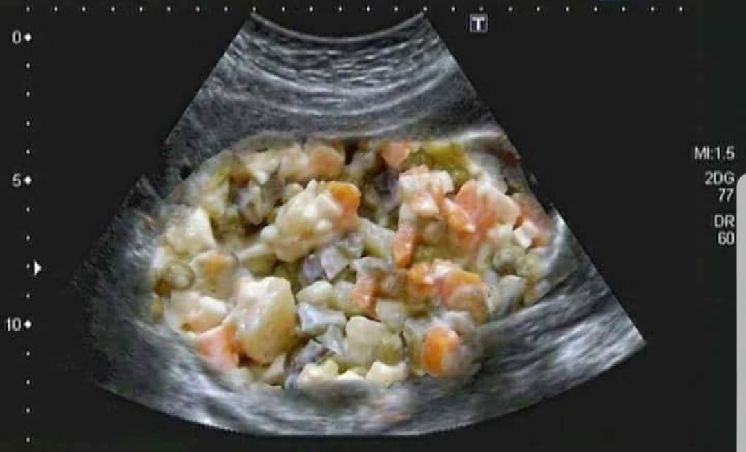 Ovako nekako to izgleda kod nas ovih dana