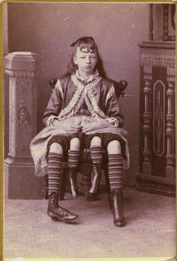 Žena s četiri noge