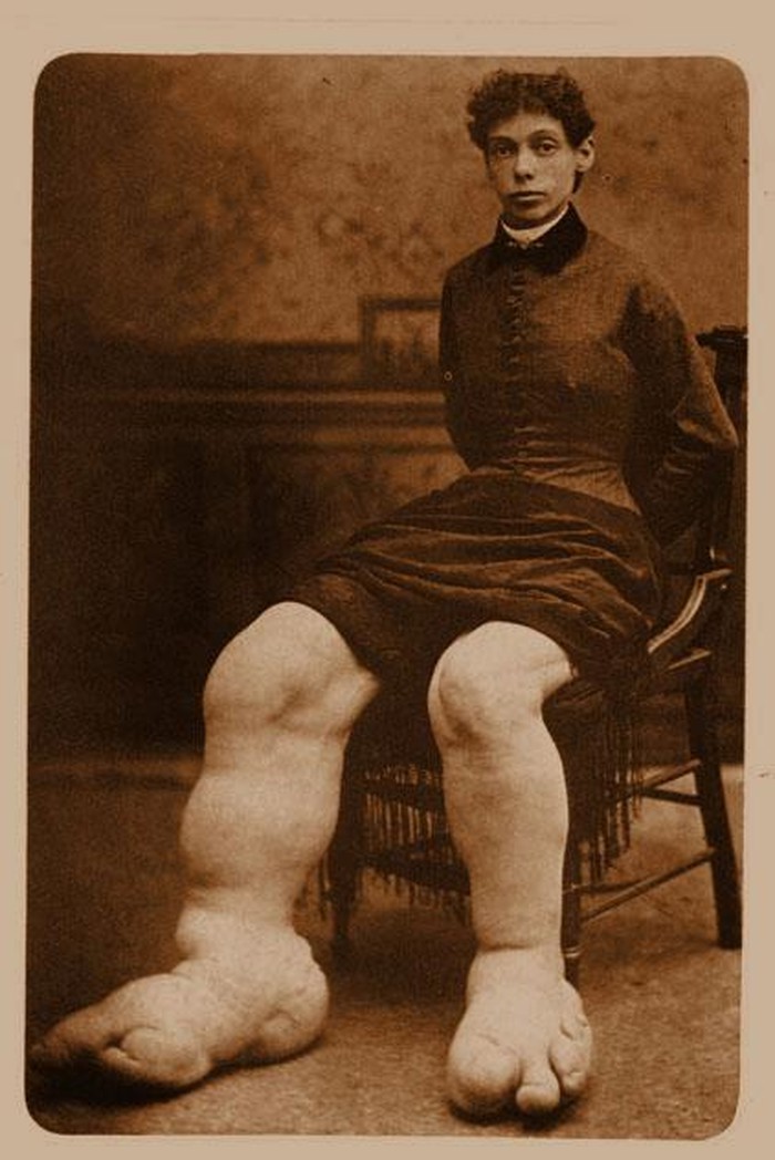 Cura bila živući Big Foot