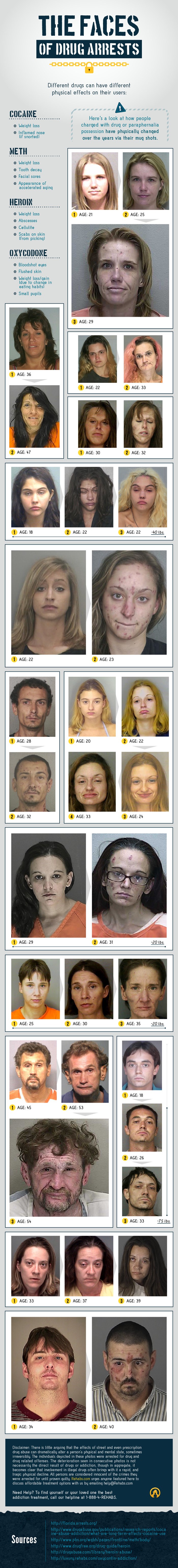 Ovo je napravila droga: Pogledajte slike prije i poslije