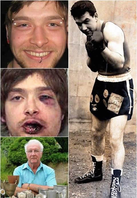 Pljačkao penzića, pobrao batine života