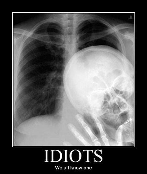 Svi imamo svog idiota u životu