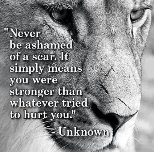 Ne srami se ožiljaka