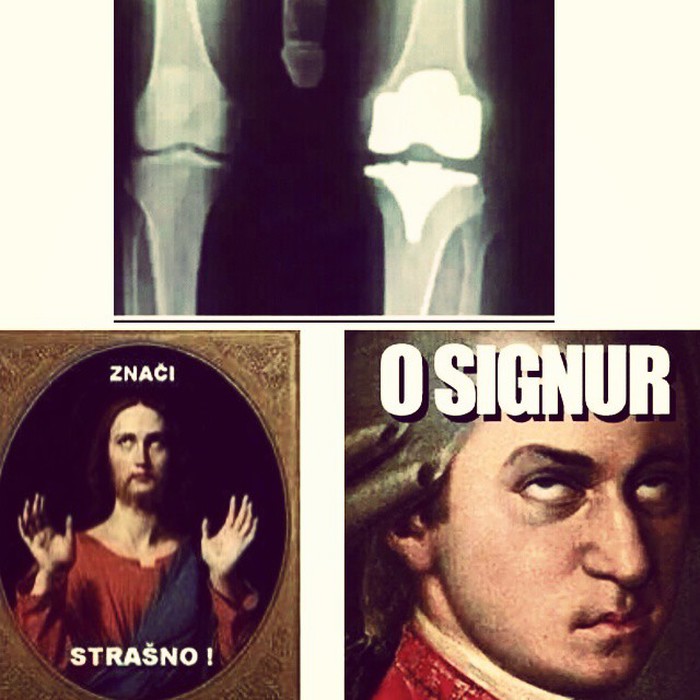 @wasn.t_me on Instagram: “#koljeno boli#knee#ginocchio ??”
