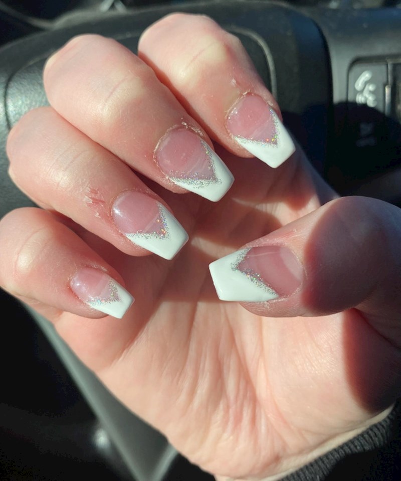 7. Možda najmanje grozan primjer od svih, ali pogledajte samo kožicu oko noktiju...