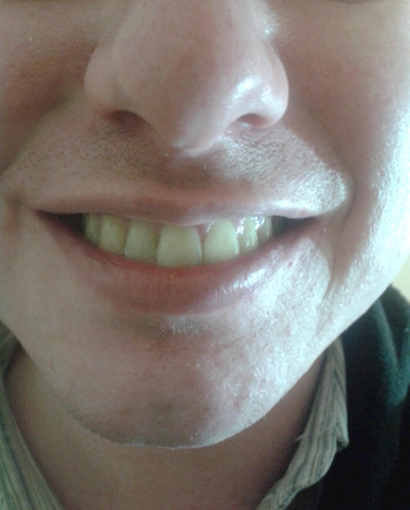 7. Ovo još nismo vidjeli, točno na sredini ima jedan zub