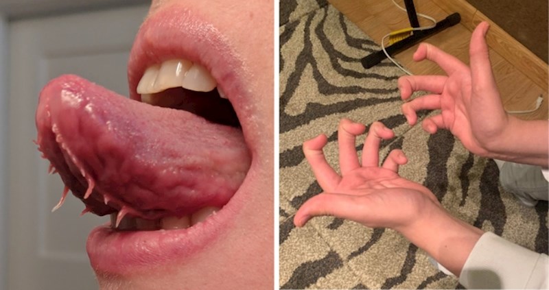 10+ ljudi rodili su se s neobičnim tjelesnim karakteristikama, od nekih prizora ćete se naježiti