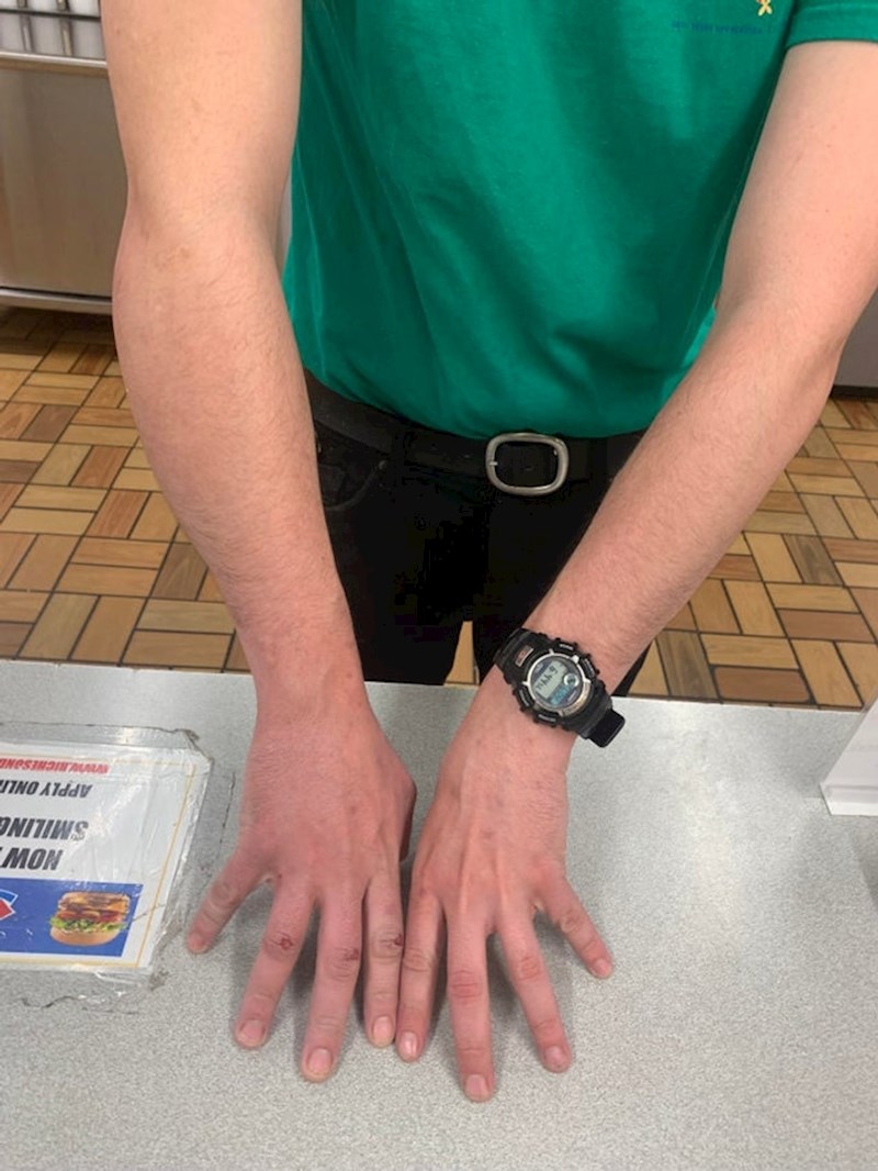 8. Razlika u veličini ruku 😳